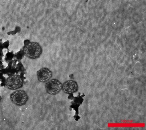 The Transmission Electron Microscopic Tem Image Of Chimeric L L