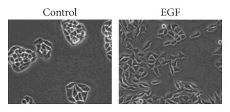 Egf Induced Emt In Colorectal Cancer Cells Caco Cells Were Treated