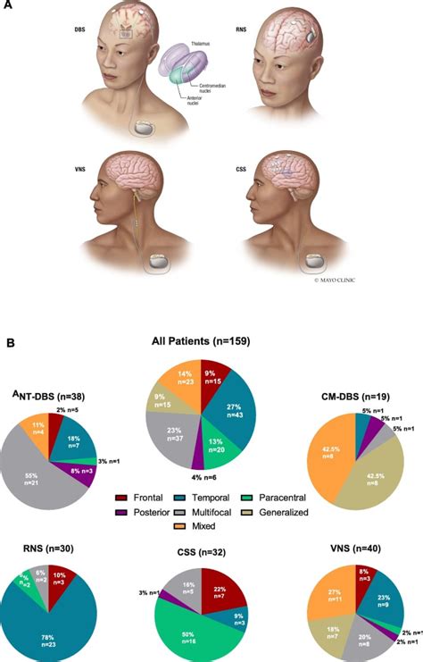 Invasive Neuromodulation For Epilepsy Comparison Of Multiple