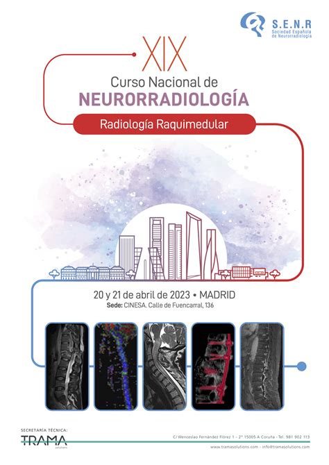 Xix Curso Nacional De Neurorradiología Senr Bienvenid Al Portal De