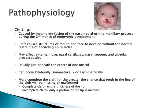 Ppt Cleft Lip And Cleft Palate Powerpoint Presentation Free Download