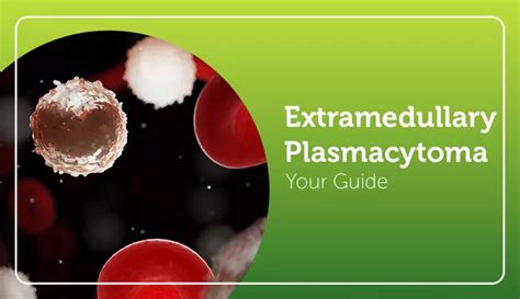 Extramedullary Plasmacytoma (EMP): Your Guide | MyMyelomaTeam