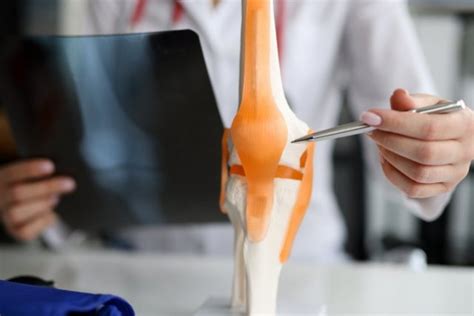 Как диагностируется перелом надколенника? | MedAboutMe