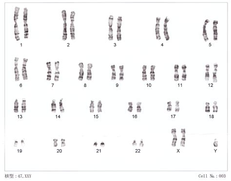 Chapter 15 Chromosomal Genetics Biology For Majors Openstax Import