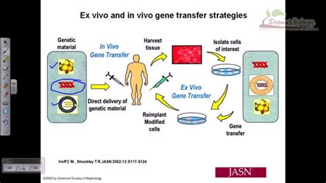 Gene Therapy Lecture 3 In Vitro Gene Therapy Youtube