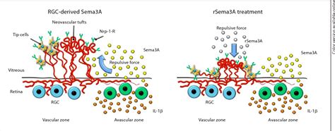 Figure 1 From Understanding Retinopathy Of Prematurity Update On Pathogenesis Semantic Scholar