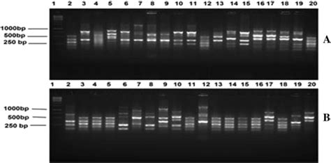 ERIC PCR Profiles Of Representative S Aureus Isolates Isolated From