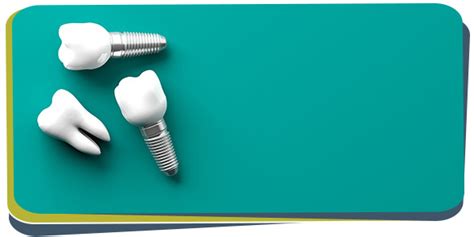 What To Expect From A Dental Implant Procedure