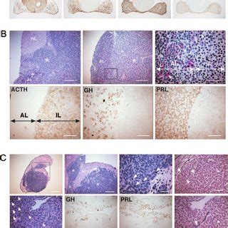 Crh Expression In The Hypothalamus And Amygdala Of Male Mice Crh Mrna