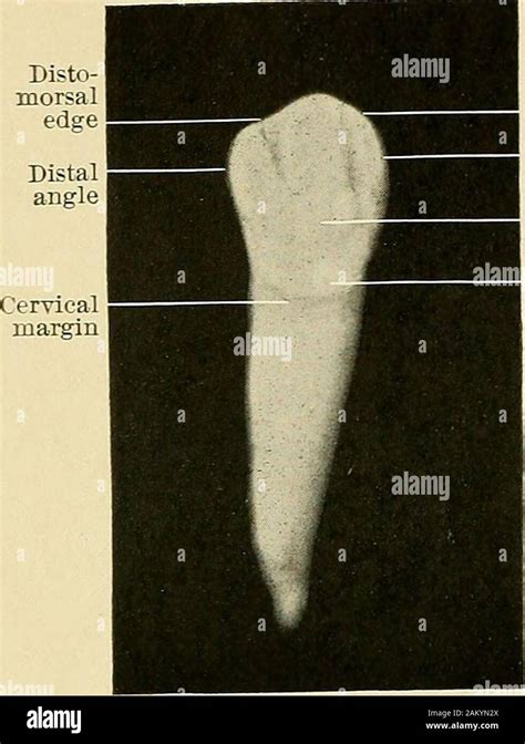 Principles And Practice Of Operative Dentistry Fig 28—superior