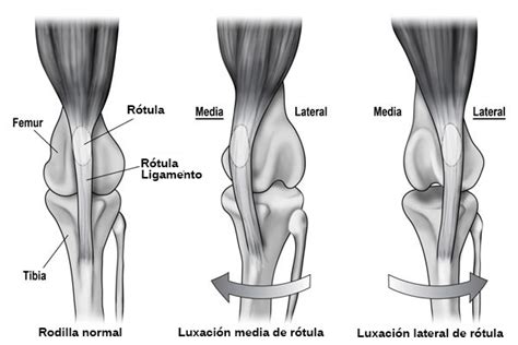 Luxación de rótula ⋆ Vellcan veterinarios