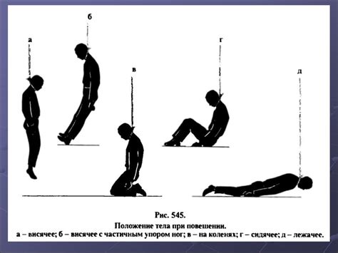 Задушение (асфиксия) от действия механических факторов - презентация онлайн