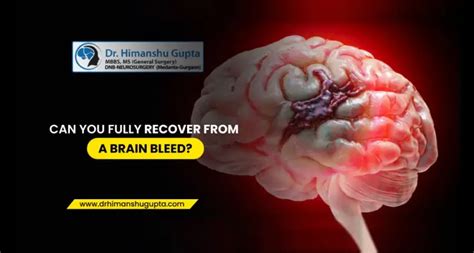 Can You Fully Recover From A Brain Bleed In 2022 Brain Hemorrhage Surgery In Jaipur