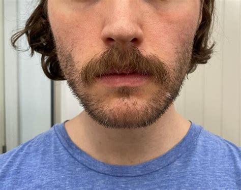 How Should I Trim And Shape This Rmoustache