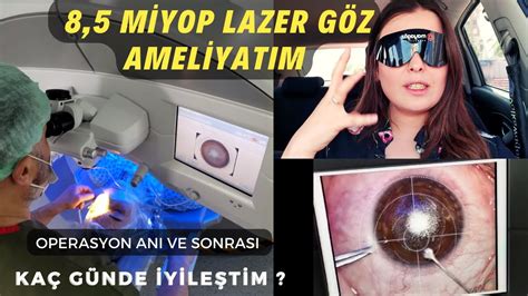 LAZER GÖZ AMELİYATI İLE GÖZLÜĞE SON ÖNCESİ SONRASI NO TOUCH SMİLE