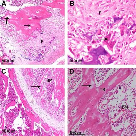 Estudio Histopatol Gico E Inmunohistoqu Mico De La Eficacia