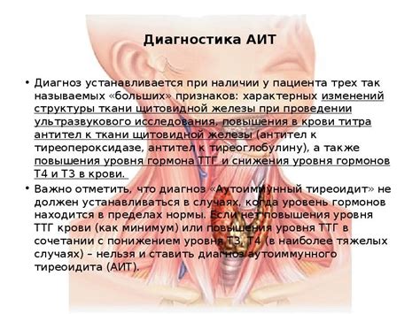 АУТОИМУННЫЙ ТИРЕОИДИТ