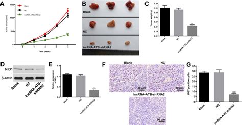 Lncrna Atb Silencing Ameliorated The Severity Of Ovarian Cancer In