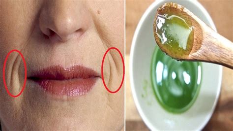 In 3 Days Remove Mouth Wrinkles Lift Corner Of Your Mouth Naturally