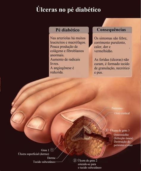 Les Es Cut Neas Prim Rias E Secund Rias Significado E Tratamento