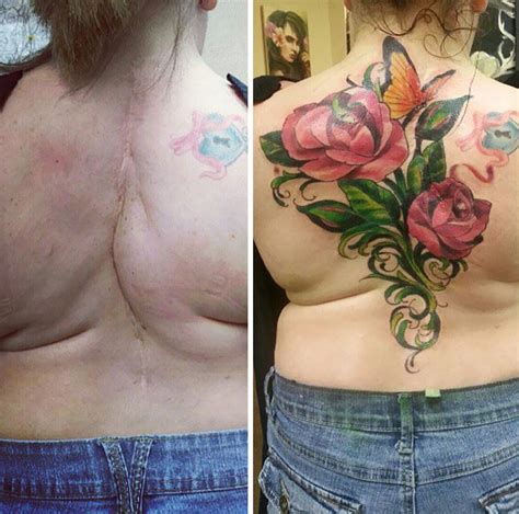 Incredible Scar Tattoo Cover Ups Inspirationfeed