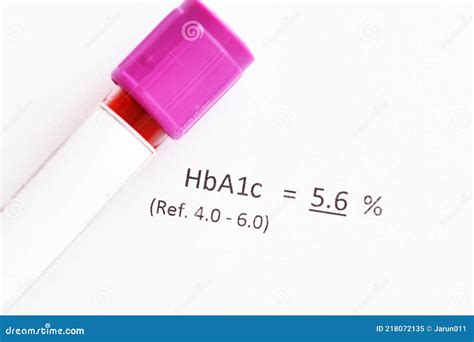 Resultado Normal De La Prueba Hba1c Imagen De Archivo Imagen De Forma Hemoglobina 218072135