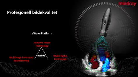 Mindray TE Air trådløs ultralyd adCARE AS