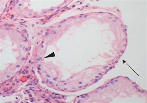 Histopathological Features Of Testicular Tissue In The Control