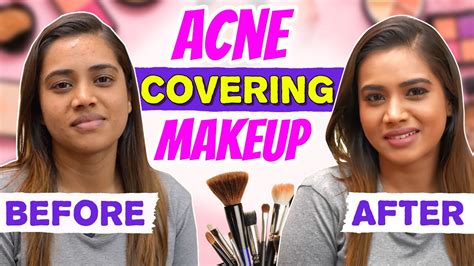 How To Cover Acne Prone Skin And Hyperpigmentation Covering Acne Makeup