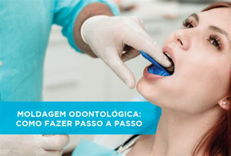 Moldagem Odontol Gica Como Fazer Passo A Passo Blog Odonto Equipamentos