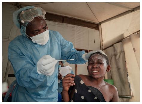 Mpox Cases Rise In DR Congo As Country Awaits Vaccines