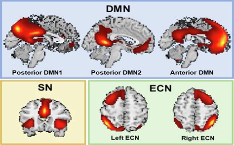 Resting State Brain Networks Identified By The Independent Component Download Scientific