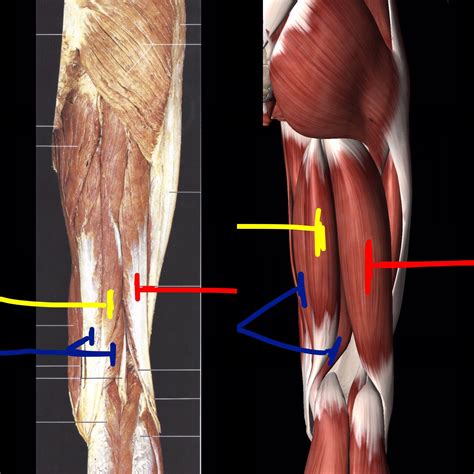 HAMSTRING MUSCLES (made up of 3 muscles) {right posterior view} #love # ...