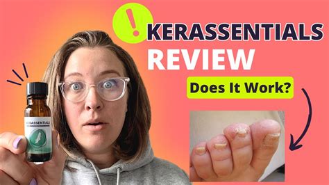 Kerassentials Review From A Real Customer Youtube