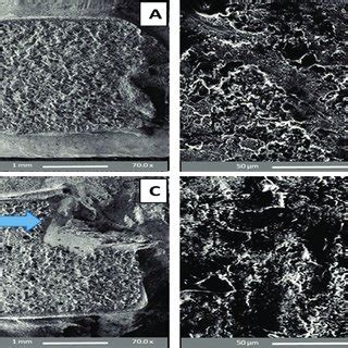 Sem Images Of Premolar Enamel Surfaces Etched With Phosphoric Acid