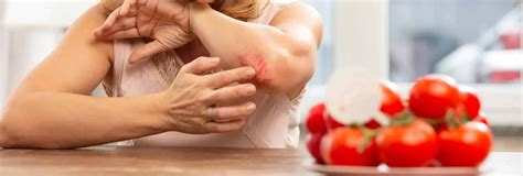 Tomato Allergy And Intolerance Symptoms Intolerancelab