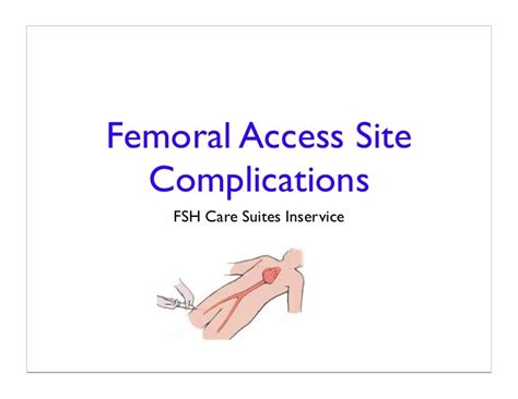 Femoral Site Complications