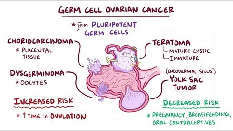 ovarian cancer tumor types