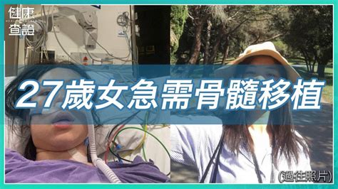 患骨髓性及淋巴性白血病 27歲女急需骨髓移植 健康查證 健康查證 Health Hacker Line Today