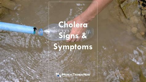 Cholera Signs and Symptoms: Guide For Filipinos – Medical Trends Now