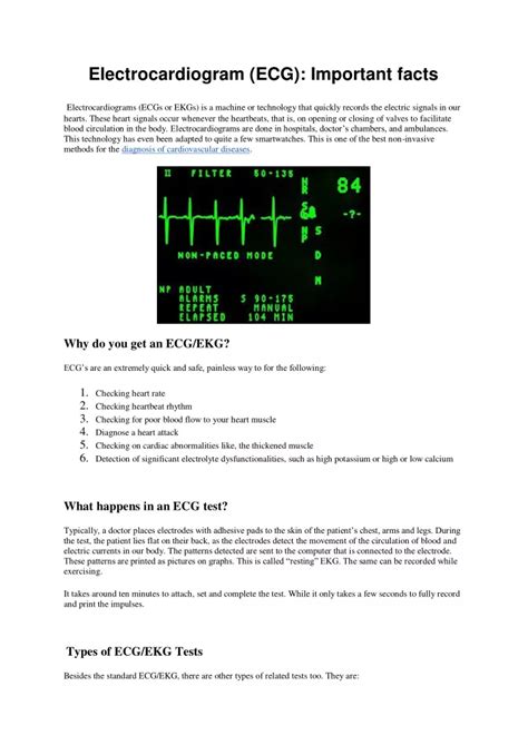 Ppt Electrocardiogram Ecg Important Facts Powerpoint Presentation