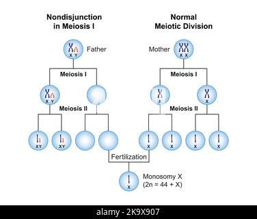 Scientific Designing Of Turner Syndrome Monosomy X Karyotype