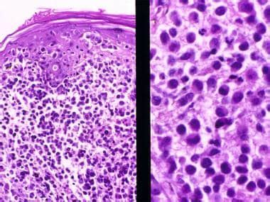 Langerhans Cells Histology