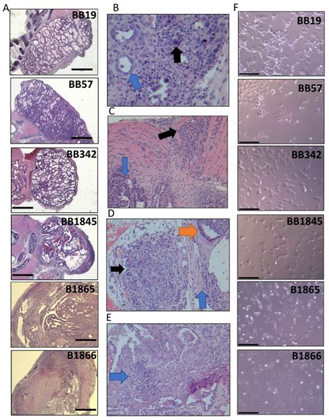 Histology And Pathological Features Of BrafV600E Driven Murine Thyroid