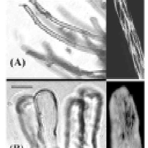 —Left image. Root hair morphology in control plant roots (A). Root... | Download Scientific Diagram