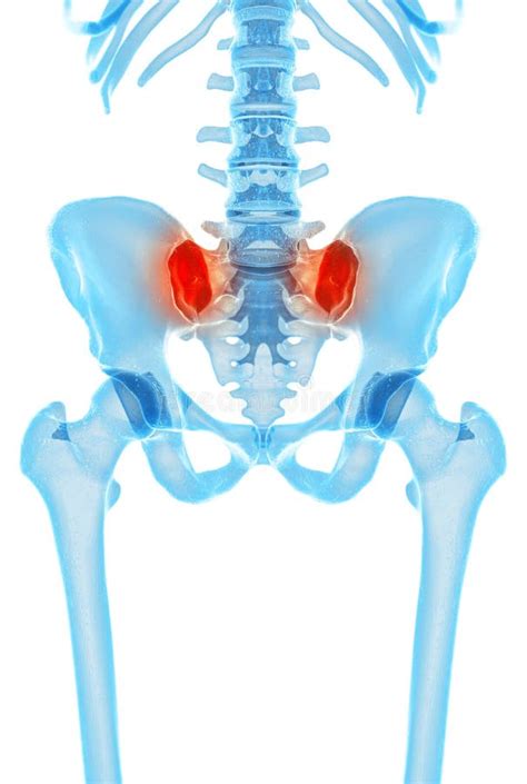 Painful Sacroiliac Joint Stock Illustration Illustration Of Cocycx