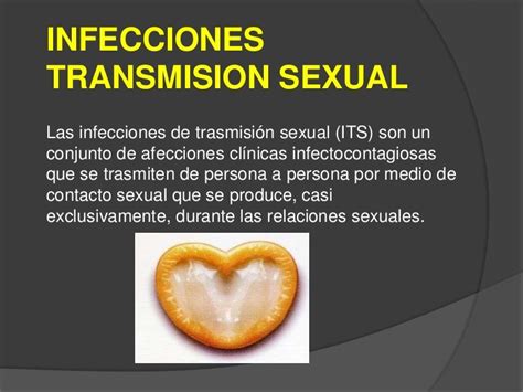 Infecciones De Transmisión Sexual