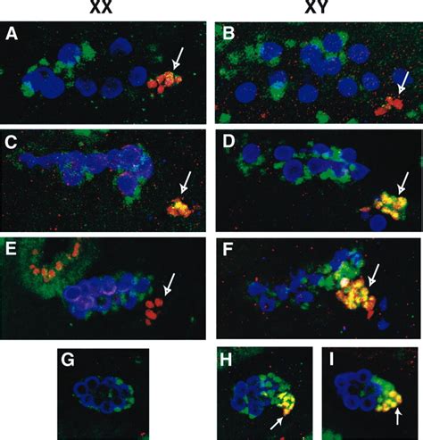 Sex Specific Apoptosis Regulates Sexual Dimorphism In The Drosophila