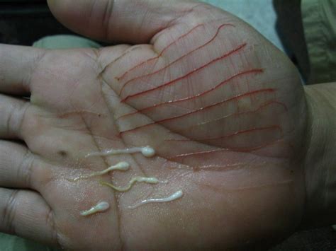 Parasitic worms in fish. - Page 2 - FishingKaki.com