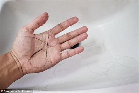 Signs To Look Out For And How To Help Excessive Hair Loss Daily Mail